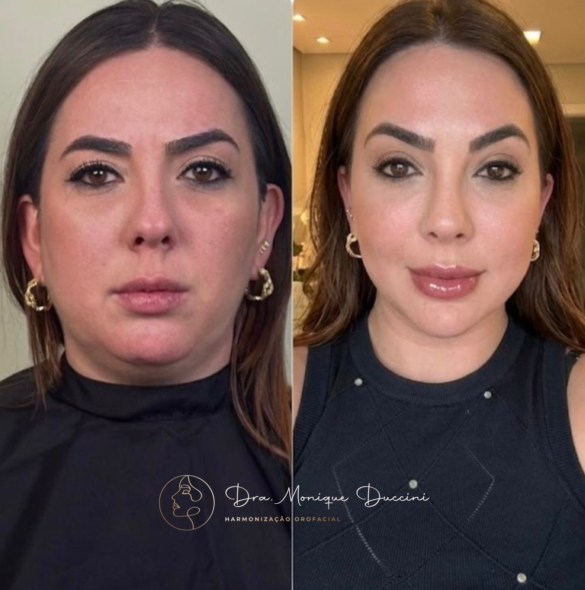 Transformação